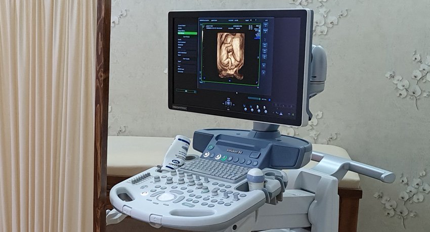 4 Boyutlu Ayrıntılı Ultrason