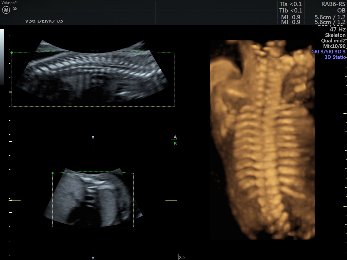 Midyatta 4 Boyutlu Ayrıntılı Ultrason