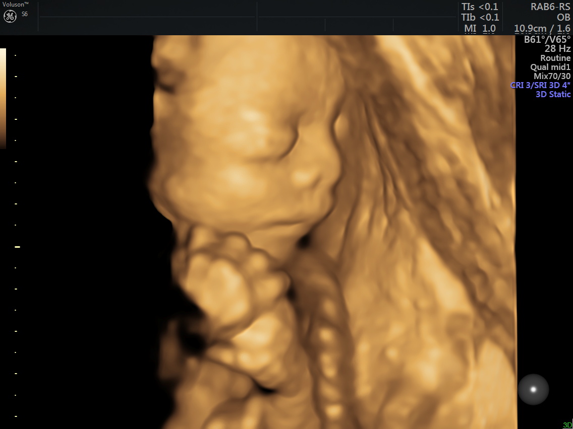 midyat kadın doğum doktoru